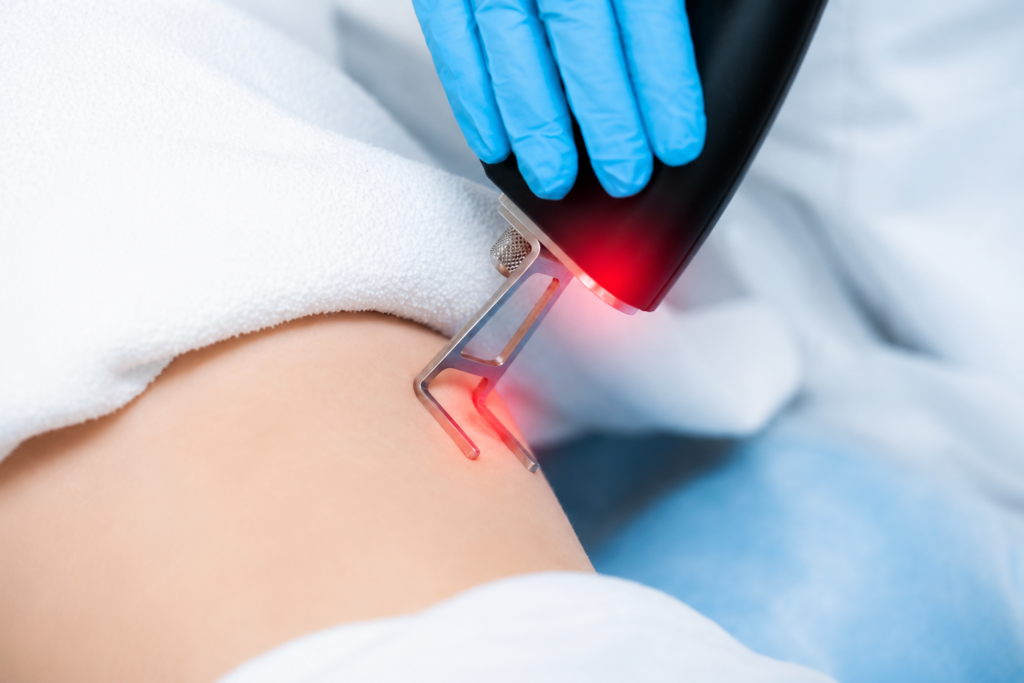 Laser Surgery