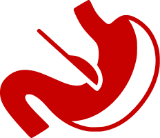 BARIATRIC SURGERY